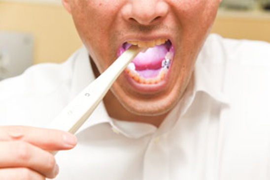 口腔内カメラ